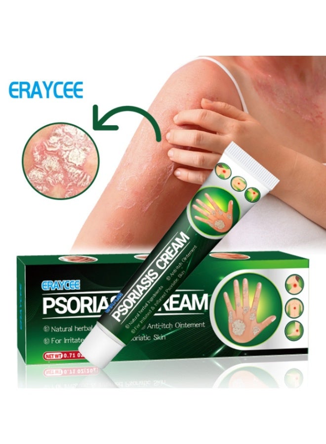 إيرايسي كريم لعلاج الصدفية - مستخلصات نباتية عشبية - عناية بالبشرة المصابة بالصدفية - تخفيف صدفية اليدين والقدمين - تخفيف الحكة - مكونات طبيعية - مرطب ومغذي - 20 غرام - Image 1